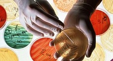 Salmonella spp, E.coli and S.aureus developed resistance to antibiotics